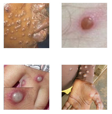 Monkeypox key characteristics